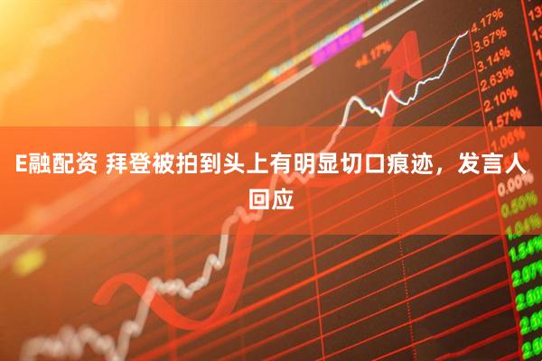E融配资 拜登被拍到头上有明显切口痕迹，发言人回应